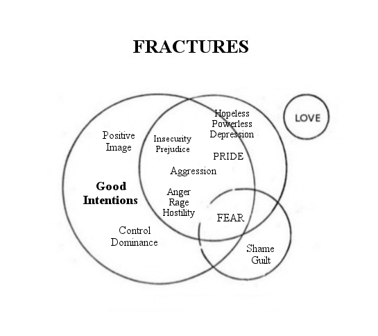 Fractures